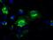 Glutamate Decarboxylase 1 antibody, MA5-24908, Invitrogen Antibodies, Immunocytochemistry image 