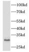 Major Histocompatibility Complex, Class II, DR Beta 5 antibody, FNab03909, FineTest, Western Blot image 