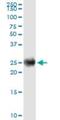 Immunoglobulin Kappa Constant antibody, H00003514-M06, Novus Biologicals, Western Blot image 