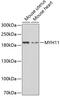Myosin Heavy Chain 11 antibody, 15-816, ProSci, Western Blot image 