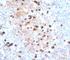 Immunoglobulin Heavy Constant Mu antibody, V2144IHC-7ML, NSJ Bioreagents, Immunohistochemistry paraffin image 