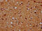 CDP-Diacylglycerol Synthase 2 antibody, CSB-PA005123LA01HU, Cusabio, Immunohistochemistry paraffin image 
