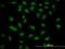 Mediator Complex Subunit 21 antibody, H00009412-M10, Novus Biologicals, Immunofluorescence image 