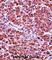 Chymotrypsin Like Elastase 3B antibody, abx027596, Abbexa, Western Blot image 