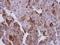Ubiquitin Conjugating Enzyme E2 T antibody, NBP2-20789, Novus Biologicals, Immunohistochemistry frozen image 