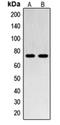SUMO Specific Peptidase 1 antibody, orb215150, Biorbyt, Western Blot image 