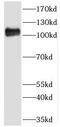 Phosphoribosylglycinamide Formyltransferase, Phosphoribosylglycinamide Synthetase, Phosphoribosylaminoimidazole Synthetase antibody, FNab03348, FineTest, Western Blot image 