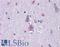 AXL Receptor Tyrosine Kinase antibody, LS-B6124, Lifespan Biosciences, Immunohistochemistry frozen image 