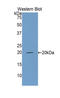 Complement Factor Properdin antibody, LS-C297401, Lifespan Biosciences, Western Blot image 