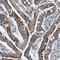 Glutathione S-Transferase Kappa 1 antibody, NBP1-89727, Novus Biologicals, Immunohistochemistry paraffin image 