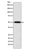 Solute Carrier Family 16 Member 1 antibody, M02240, Boster Biological Technology, Western Blot image 