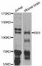 RB Transcriptional Corepressor 1 antibody, abx126458, Abbexa, Western Blot image 