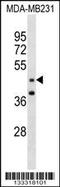 GRAM Domain Containing 2B antibody, 60-082, ProSci, Western Blot image 