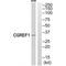 Cell Growth Regulator With EF-Hand Domain 1 antibody, A11706, Boster Biological Technology, Western Blot image 