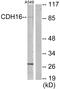 Cadherin 16 antibody, GTX87660, GeneTex, Western Blot image 
