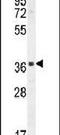 Sperm Acrosome Associated 1 antibody, PA5-24263, Invitrogen Antibodies, Western Blot image 