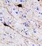 Parvalbumin antibody, PA5-47693, Invitrogen Antibodies, Immunohistochemistry paraffin image 