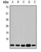 Beta-2-Microglobulin antibody, orb377942, Biorbyt, Western Blot image 
