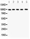 Aspartate Beta-Hydroxylase antibody, PB9478, Boster Biological Technology, Western Blot image 