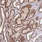 Zinc Finger BED-Type Containing 8 antibody, HPA045445, Atlas Antibodies, Immunohistochemistry paraffin image 