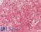 Calpain 1 antibody, LS-B14616, Lifespan Biosciences, Immunohistochemistry paraffin image 