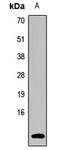 Guanylate Cyclase Activator 2B antibody, LS-C668087, Lifespan Biosciences, Western Blot image 