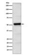 Protein Interacting With PRKCA 1 antibody, M02457-1, Boster Biological Technology, Western Blot image 