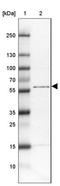 Tetratricopeptide Repeat Domain 31 antibody, NBP1-82282, Novus Biologicals, Western Blot image 