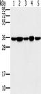 Serine/threonine-protein phosphatase PP1-gamma catalytic subunit antibody, TA351550, Origene, Western Blot image 