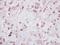 IKAROS Family Zinc Finger 2 antibody, LS-C155432, Lifespan Biosciences, Immunohistochemistry paraffin image 