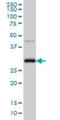 Cyclin Dependent Kinase 1 antibody, H00000983-M03, Novus Biologicals, Western Blot image 