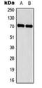 Sodium Channel Epithelial 1 Delta Subunit antibody, orb224003, Biorbyt, Western Blot image 