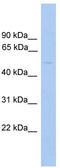 Glycerate Kinase antibody, TA342500, Origene, Western Blot image 