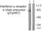 Interferon Gamma Receptor 1 antibody, LS-C199126, Lifespan Biosciences, Western Blot image 