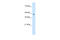 Homeobox C10 antibody, 27-656, ProSci, Enzyme Linked Immunosorbent Assay image 