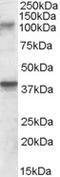 Glutamate receptor, ionotropic kainate 3 antibody, TA305864, Origene, Western Blot image 