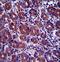 Golgi Associated PDZ And Coiled-Coil Motif Containing antibody, LS-C166578, Lifespan Biosciences, Immunohistochemistry paraffin image 