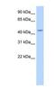 TRNA Nucleotidyl Transferase 1 antibody, NBP1-57224, Novus Biologicals, Enzyme Linked Immunosorbent Assay image 