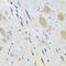 Leucine Rich Repeat Containing G Protein-Coupled Receptor 6 antibody, 22-904, ProSci, Immunohistochemistry paraffin image 