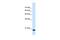 Signal Sequence Receptor Subunit 2 antibody, PA5-42730, Invitrogen Antibodies, Western Blot image 