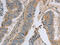 MAGE Family Member D1 antibody, CSB-PA695195, Cusabio, Immunohistochemistry paraffin image 