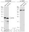 Surfactant Protein C antibody, GTX134340, GeneTex, Western Blot image 