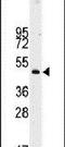 Desmin antibody, PA5-12331, Invitrogen Antibodies, Western Blot image 
