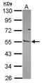 Matrix Metallopeptidase 13 antibody, GTX100665, GeneTex, Western Blot image 