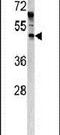 Angiopoietin Like 7 antibody, PA5-13471, Invitrogen Antibodies, Western Blot image 