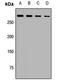 Spectrin Alpha, Erythrocytic 1 antibody, LS-C668028, Lifespan Biosciences, Western Blot image 