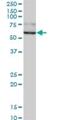 GUSB antibody, H00002990-B01P, Novus Biologicals, Western Blot image 