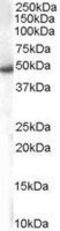 Sorting Nexin 5 antibody, GTX25983, GeneTex, Western Blot image 