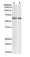 Interferon Regulatory Factor 5 antibody, GTX89902, GeneTex, Western Blot image 