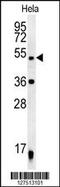DEAD-Box Helicase 47 antibody, MBS9214711, MyBioSource, Western Blot image 